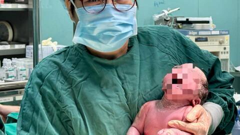 Mổ đẻ thành công cho sản phụ biến dạng xương