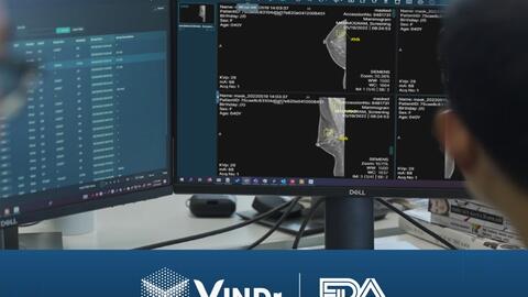 Sản phẩm AI của VinBigdata đạt chứng nhận của FDA, chính thức tiến vào thị trường Mỹ