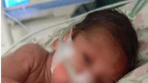 Cứu sống trẻ sơ sinh 26 tuần tuổi nặng 700 gram