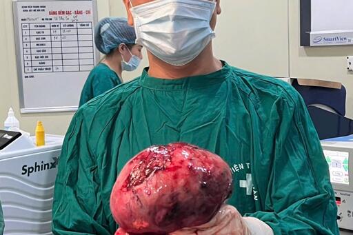 Phẫu thuật thành công khối u xơ tử cung khổng lồ gần 10kg