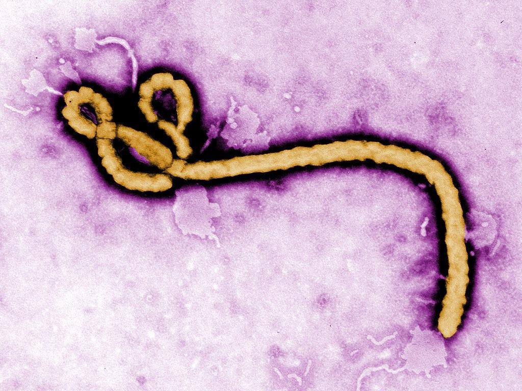 Virus Ebola. Ảnh: Getty Images