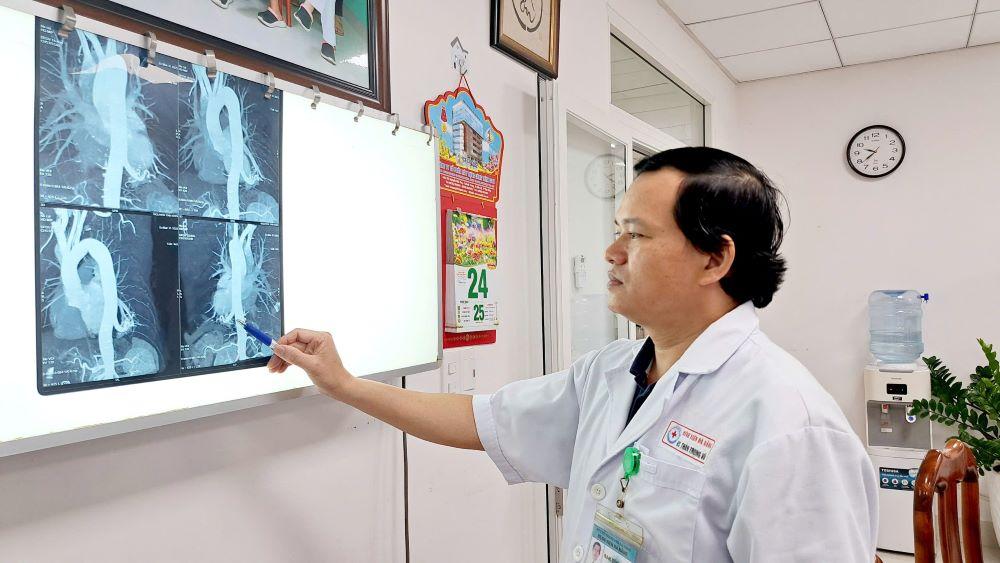 Đây là một bệnh lý bẩm sinh hiếm gặp, ít khi được chẩn đoán ở người trưởng thành. Ảnh: Bệnh viện Đà Nẵng