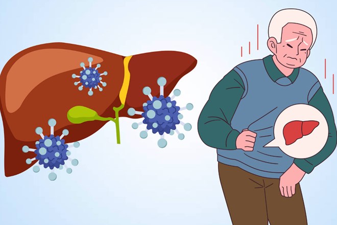 Sự khác biệt giữa viêm gan B và viêm gan C